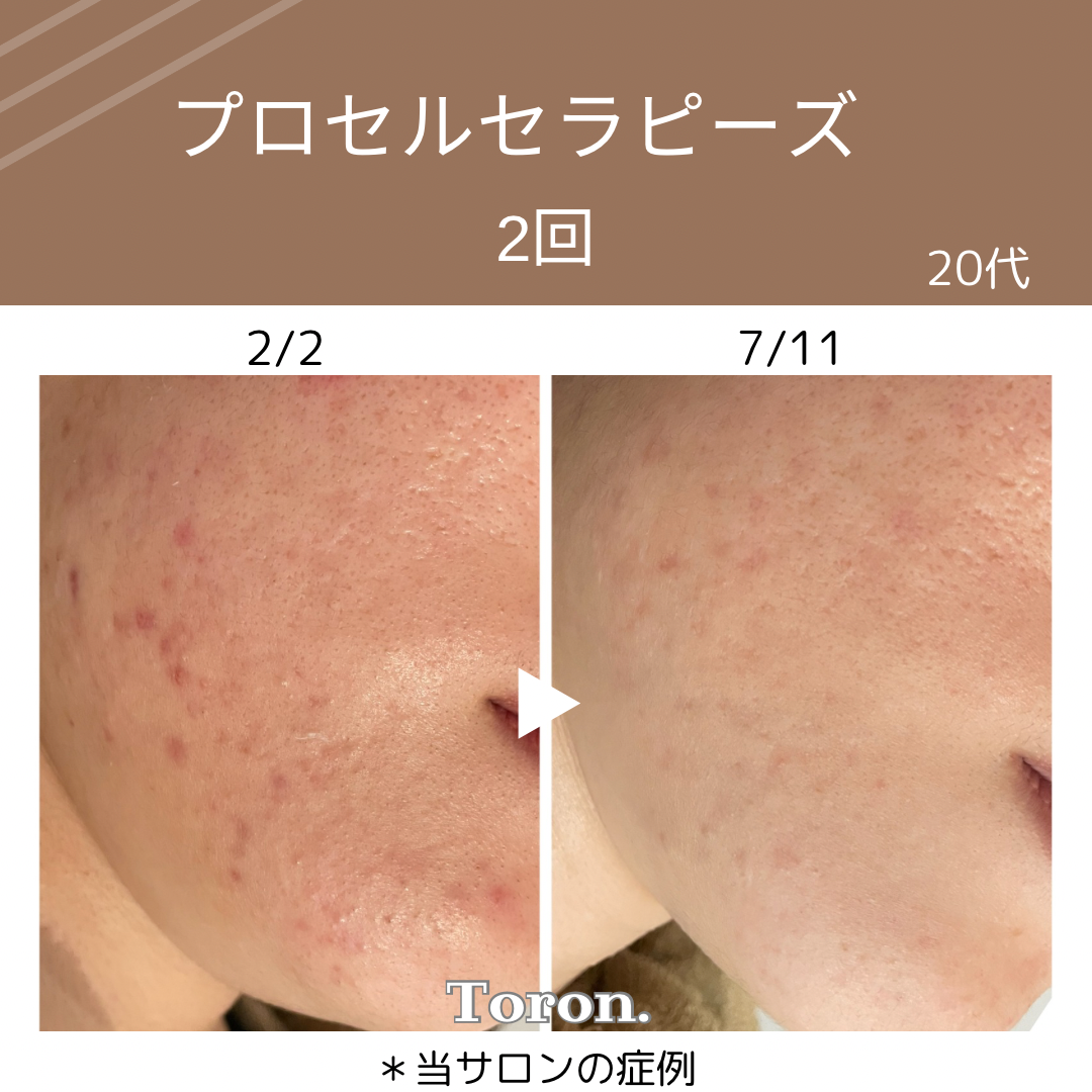 緑、ミニマリスト、環境保護、 