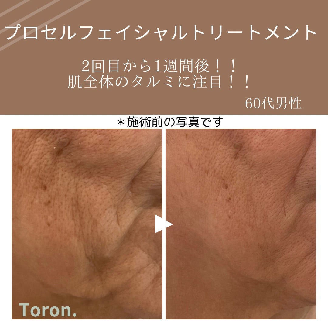 プロセルセラピーズ　機器 遂に日本上陸！プロセルセラピーズとは？｜プロセルセラピーズ熊本｜毛