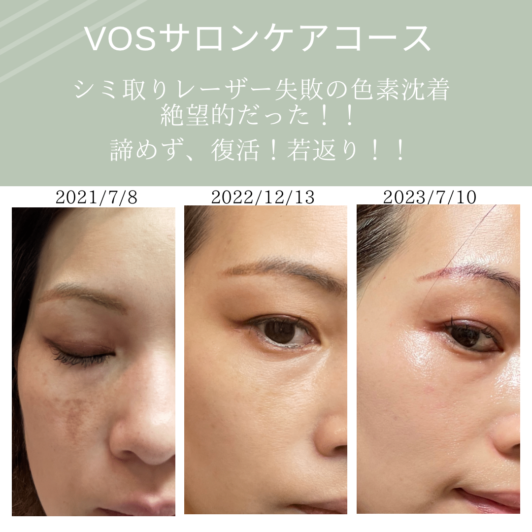 VOSサロンケア 【公式通販】