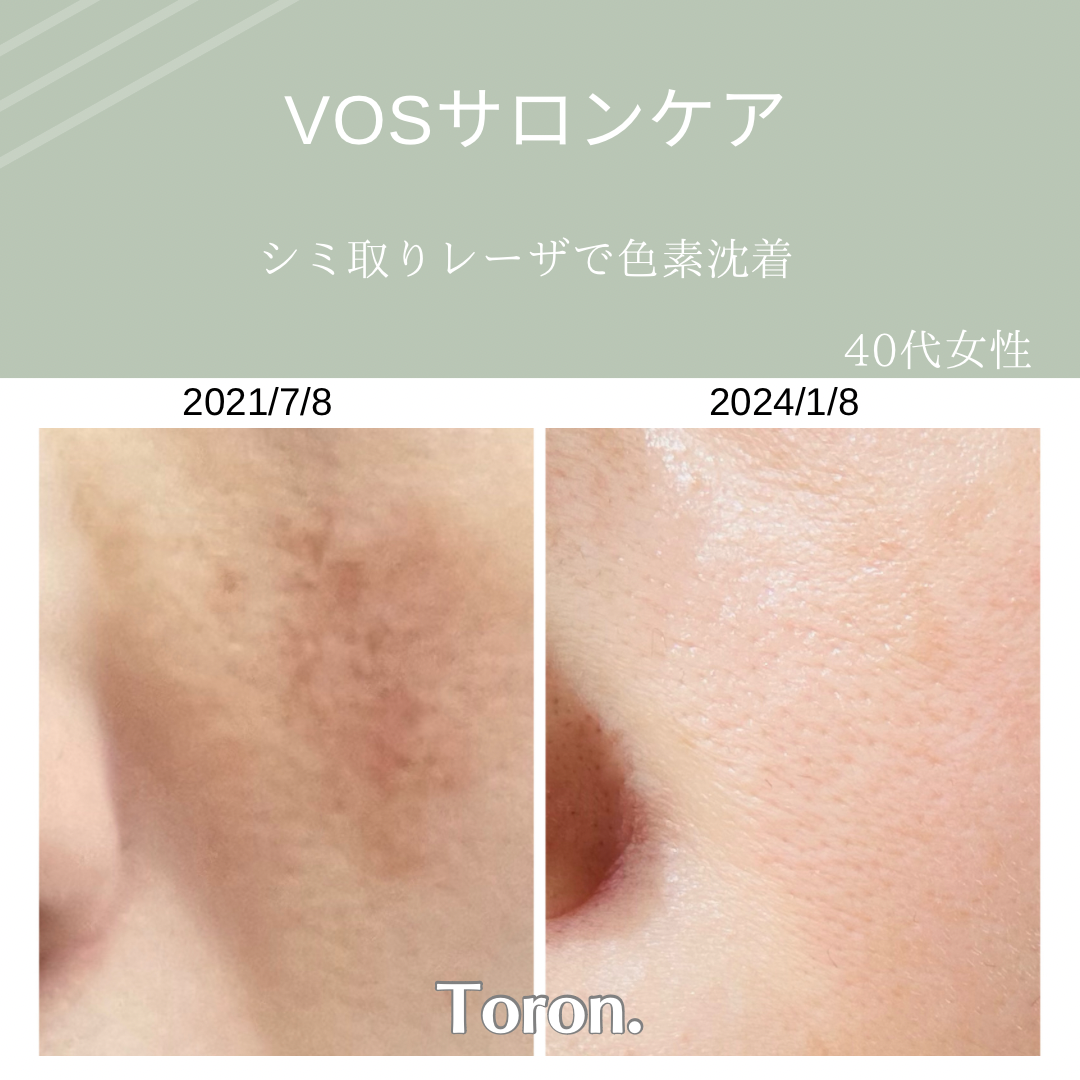 ディスカウント VOSサロンケア