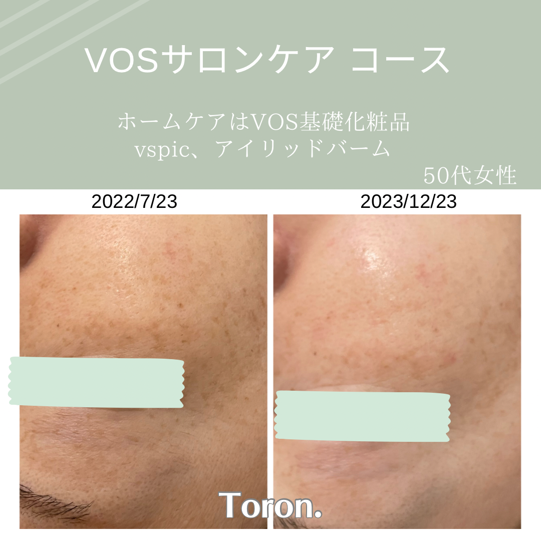 VOS | Toron.