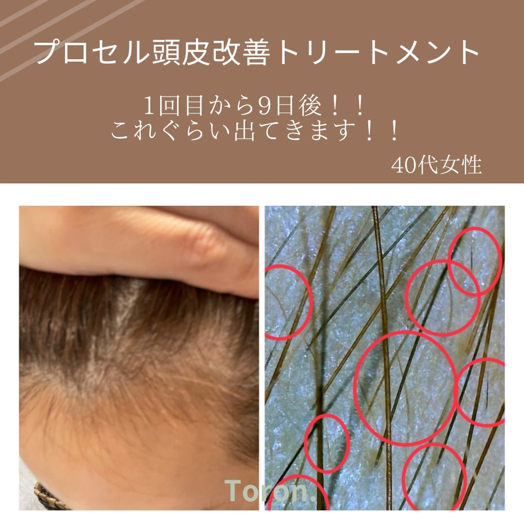 プロセルセラピーズ ProCell Therapies Japan - プロセルセラピーズ ジャパン