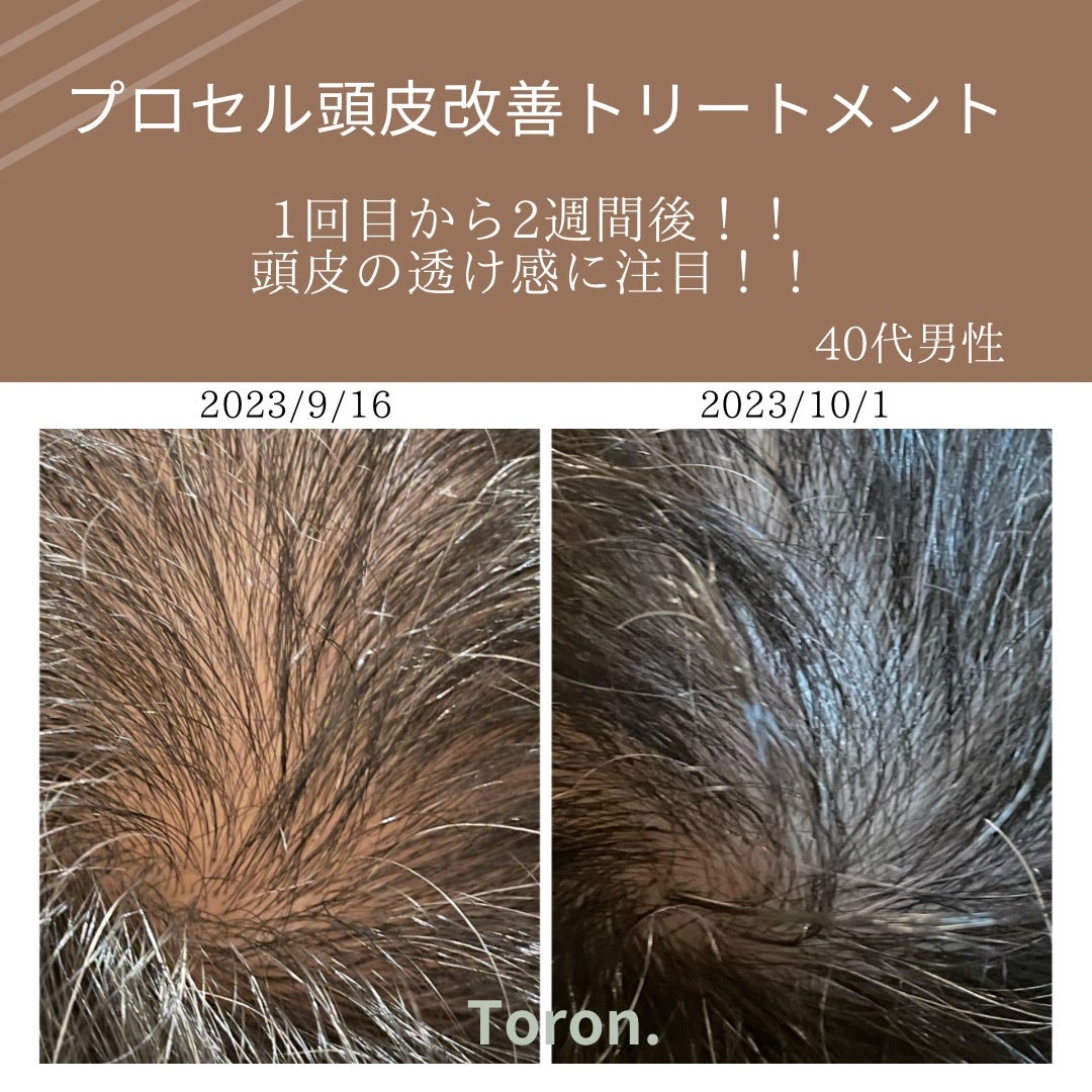 プロセルセラピーズ本体