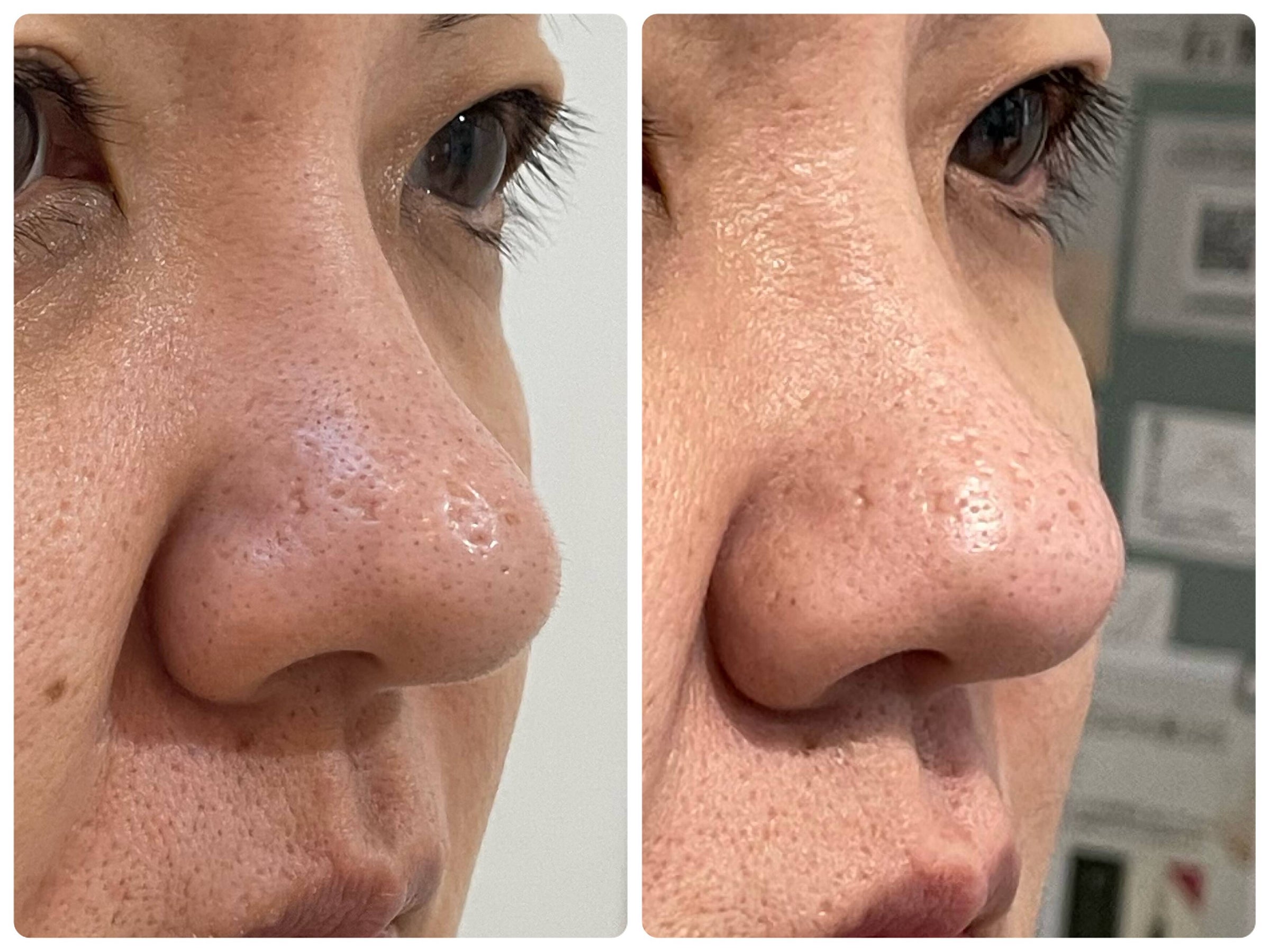 procell theraples プロセルセラピーズ | Toron.