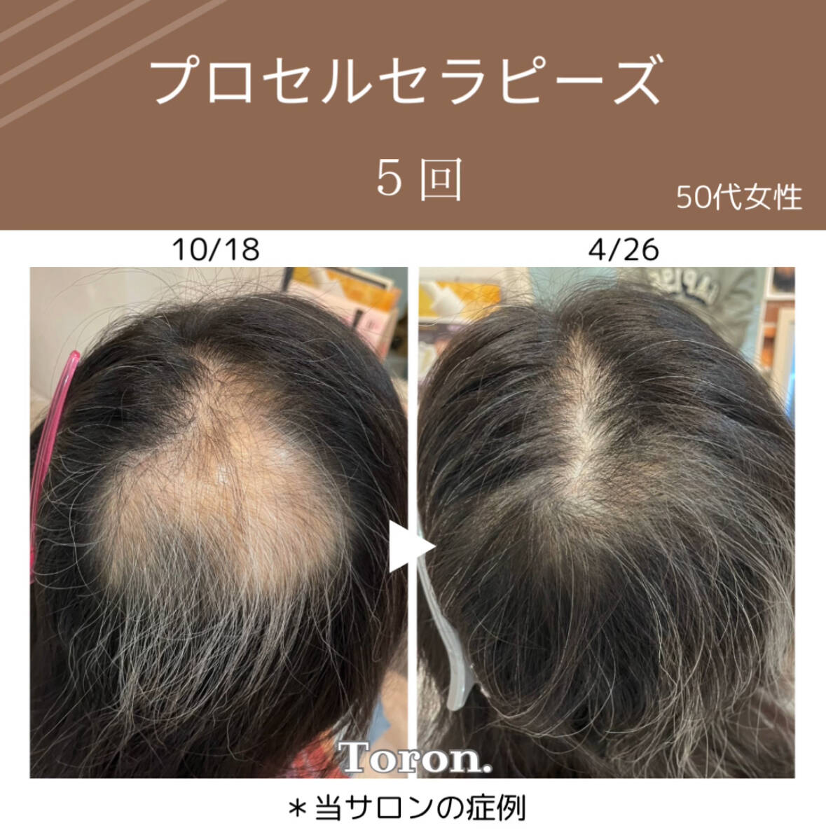 プロセルセラピーズ本体 プロセルセラピーズ(本体)