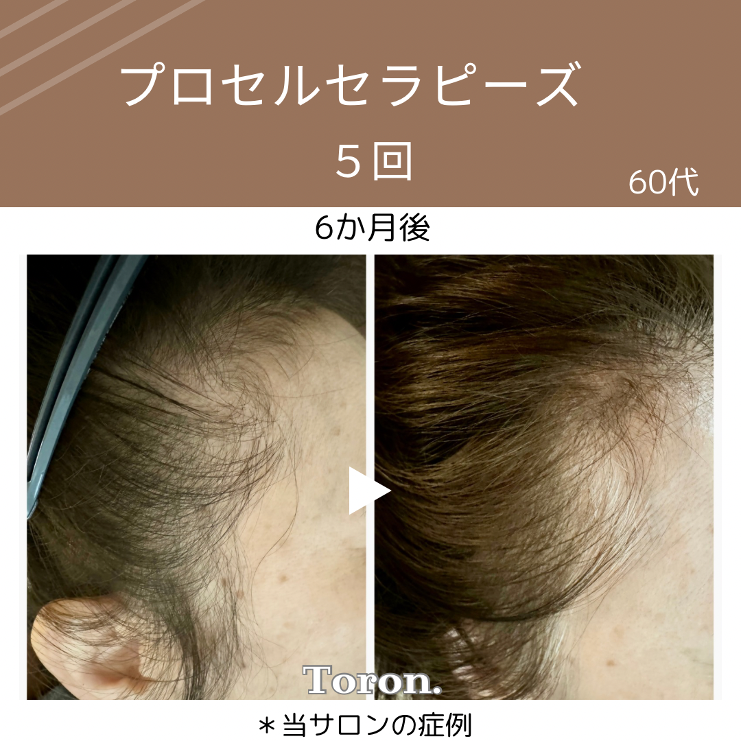 procell theraples プロセルセラピーズ | Toron.