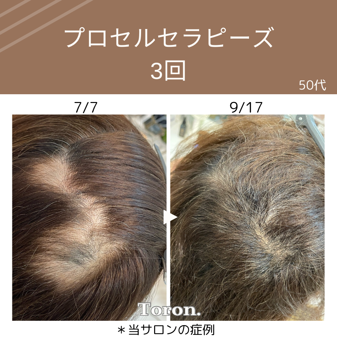 procell theraples プロセルセラピーズ | Toron.