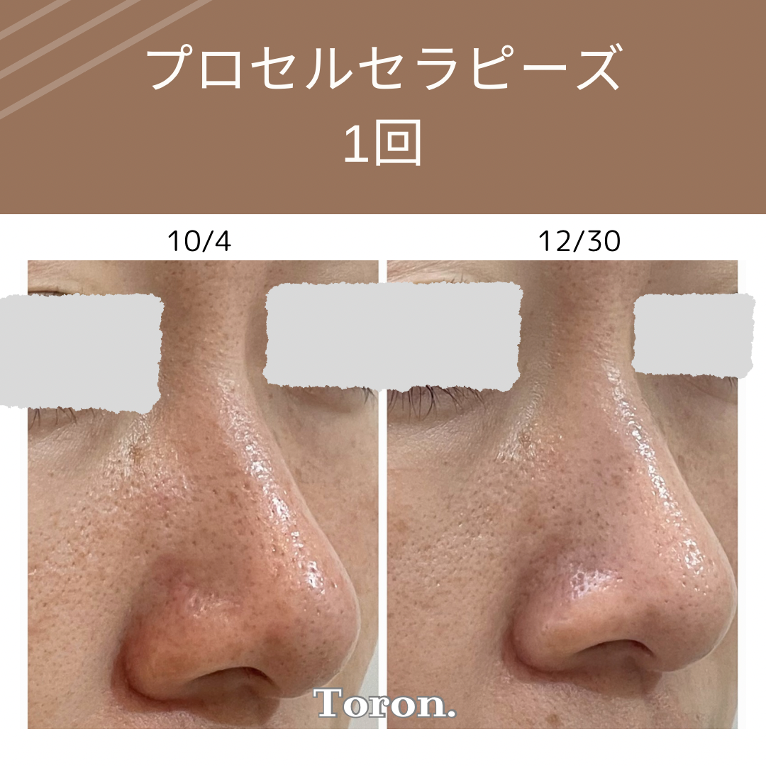 プロセルセラピーズ　機器 遂に日本上陸！プロセルセラピーズとは？｜プロセルセラピーズ熊本｜毛